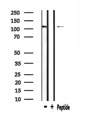 Polyclonal Rabbit anti-Human CACNA2D4 Antibody (IF, WB)