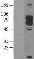 DAB1 Protein (Over-Expression Lysate Myc-DDK (Flag))