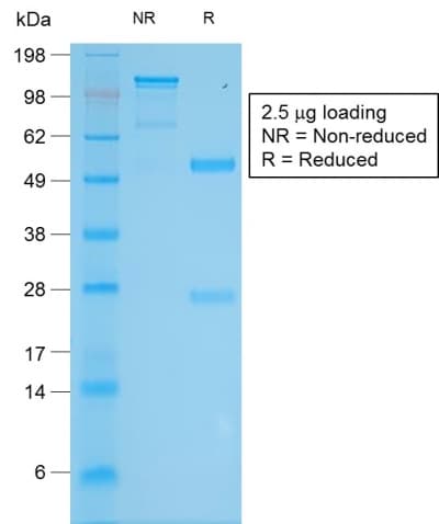 Recombinant Monoclonal Rabbit anti-Human Tyrosinase Antibody (clone TYR/2024R, Azide-free,Carrier-free, IHC)