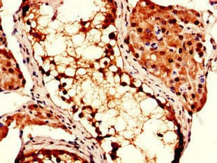 Polyclonal Rabbit anti-Human COPS7B / CSN7B Antibody