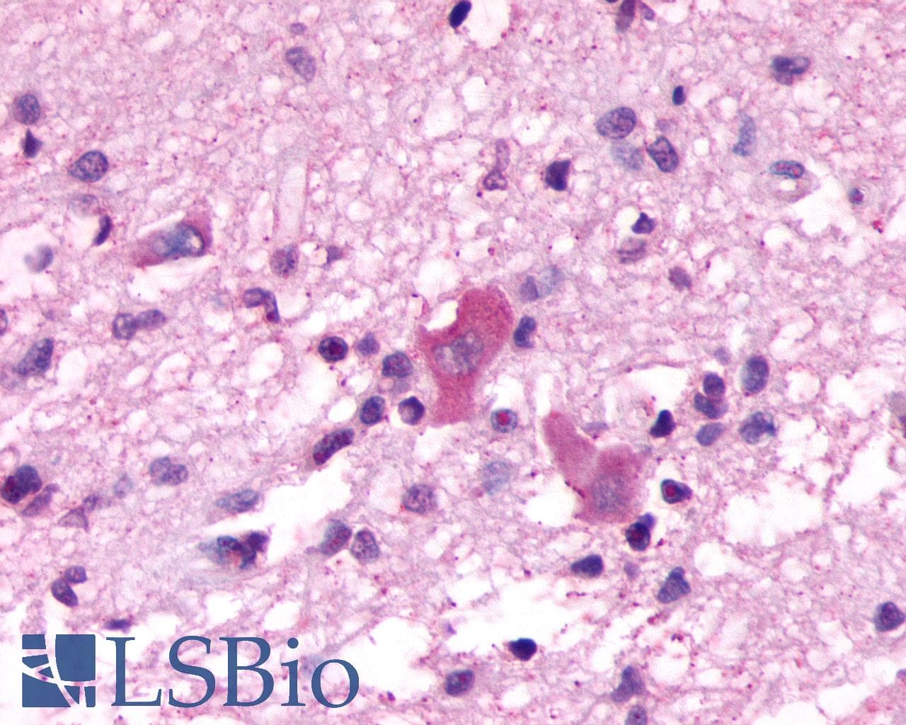 PathPlus™ NMBR Antibody (Cytoplasmic Domain)