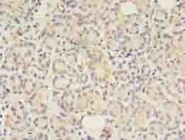 GIT2 Antibody