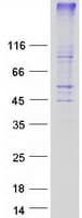 Human GPR171 Protein (Recombinant Myc-DDK (Flag))