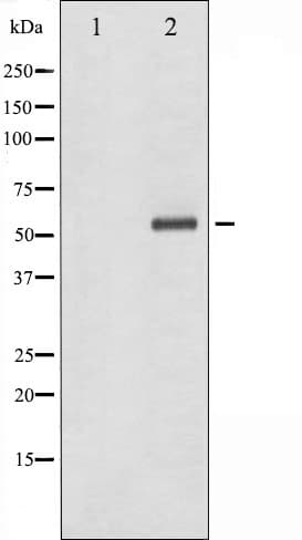 CHEK1 / CHK1 Antibody (phospho-Ser286)