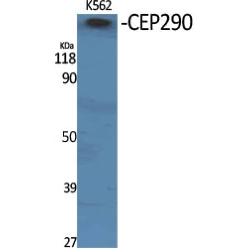 CEP290 Antibody (740-820 aa, Internal)