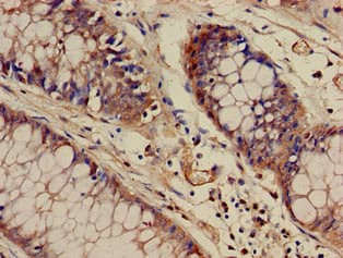WASF1 / WAVE Antibody