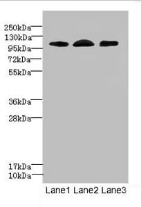 EPHB4 / EPH Receptor B4 Antibody
