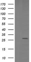 Monoclonal Mouse anti-Human LGALS3 / Galectin 3 Antibody (clone 1G8, Carrier-free, IHC, IF, WB)
