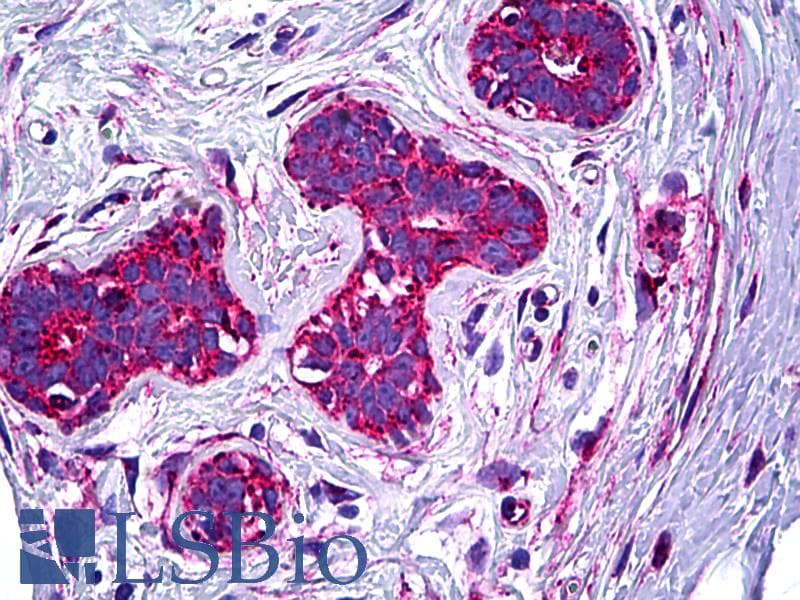 PathPlus™ Melanoma Antigen NKI/C3 Antibody (clone NKI/C3, Concentrated)