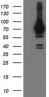 HSPA6 / HSP70B' Antibody (clone OTI1D12)