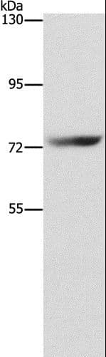 Polyclonal Rabbit anti-Human SENP1 Antibody (IHC, WB)