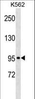 Polyclonal Rabbit anti-Human c-Kit / CD117 Antibody (aa937-966, WB)