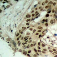 XPO5 / Exportin 5 Antibody