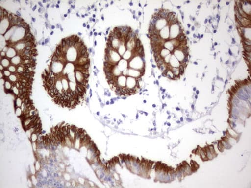 Acidic Cytokeratin Antibody (clone 5F9)