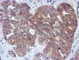 TIP48 / RUVBL2 Antibody (clone OTI1D9)