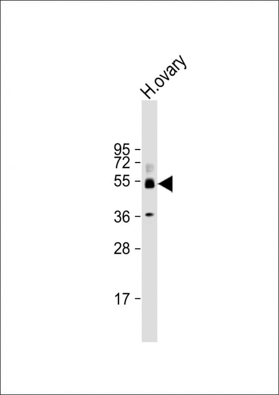 Polyclonal Rabbit anti-Human SH3BP5 / SAB Antibody (N-Terminus, WB)