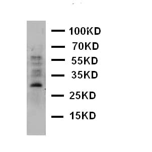 Polyclonal Rabbit anti-Human AQP8 / Aquaporin 8 Antibody (aa1-19, WB)