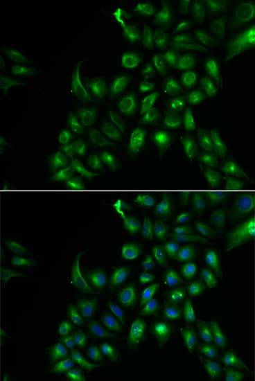 TSPAN7 / CD231 Antibody