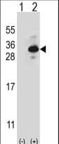 CLTB Antibody