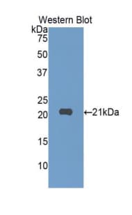SIGLEC10 Antibody (aa571-697)