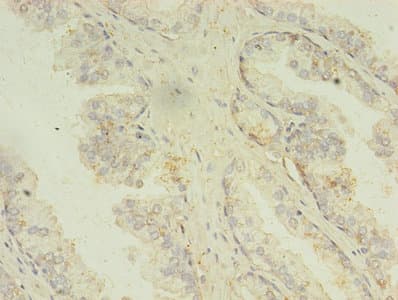 MAPK13 / p38delta Antibody