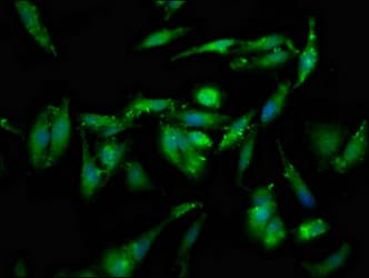 Polyclonal Rabbit anti-Human GSPT1 Antibody (IHC, IF)