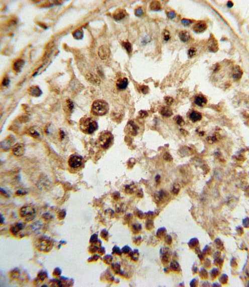 HSD17B3 Antibody (aa89-118)