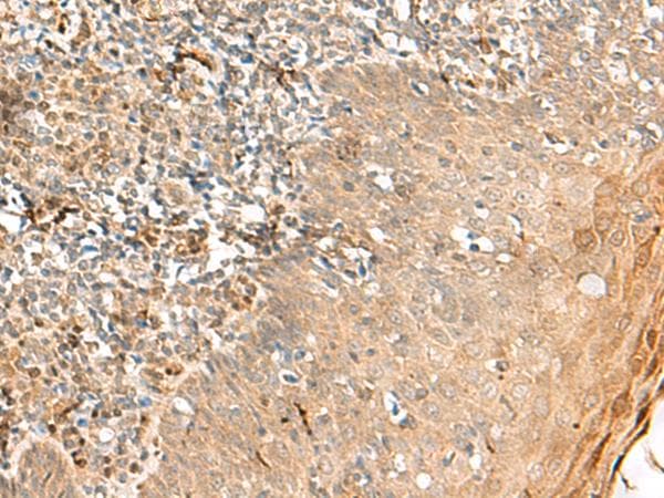 ZNF397 Antibody