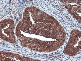DSTN / Destrin Antibody (clone OTI1G8, Carrier-free)