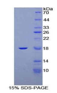 Rat PR / Progesterone Receptor Protein (Recombinant His-T7)