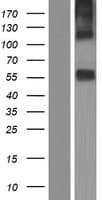 SLC16A6 / MCT6 Protein (Over-Expression Lysate Myc-DDK (Flag))