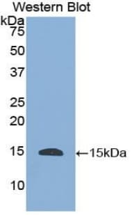 HTN1 / Histatin-1 Antibody (aa20-57, PE)