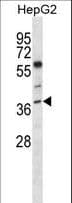 Polyclonal Rabbit anti-Human NEIL2 Antibody (aa67-96, WB)