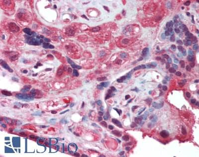 IHC-plus™ Polyclonal Rabbit anti-Human ATG18 / WIPI1 Antibody (IHC, WB)