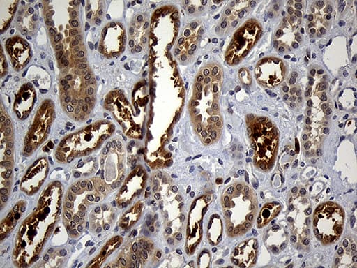 Monoclonal Mouse anti-Human GRB7 Antibody (clone OTI6H2, IHC, WB)