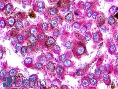 PathPlus™ UTS2R / GPR14 Antibody (N-Terminus)