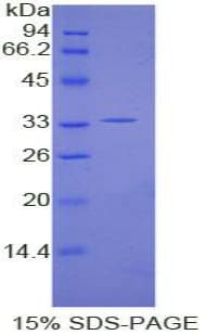 Human KPNA1 / Importin Alpha 5 Protein (Recombinant 6His, N-terminus)