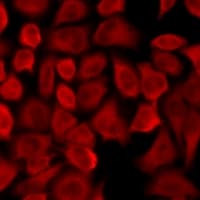 PNLIP / PL / Pancreatic Lipase Antibody