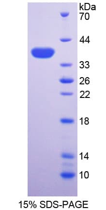 Mouse ALPL / Alkaline Phosphatase Protein (Recombinant His)