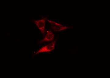 ARHGEF10 / GEF10 Antibody