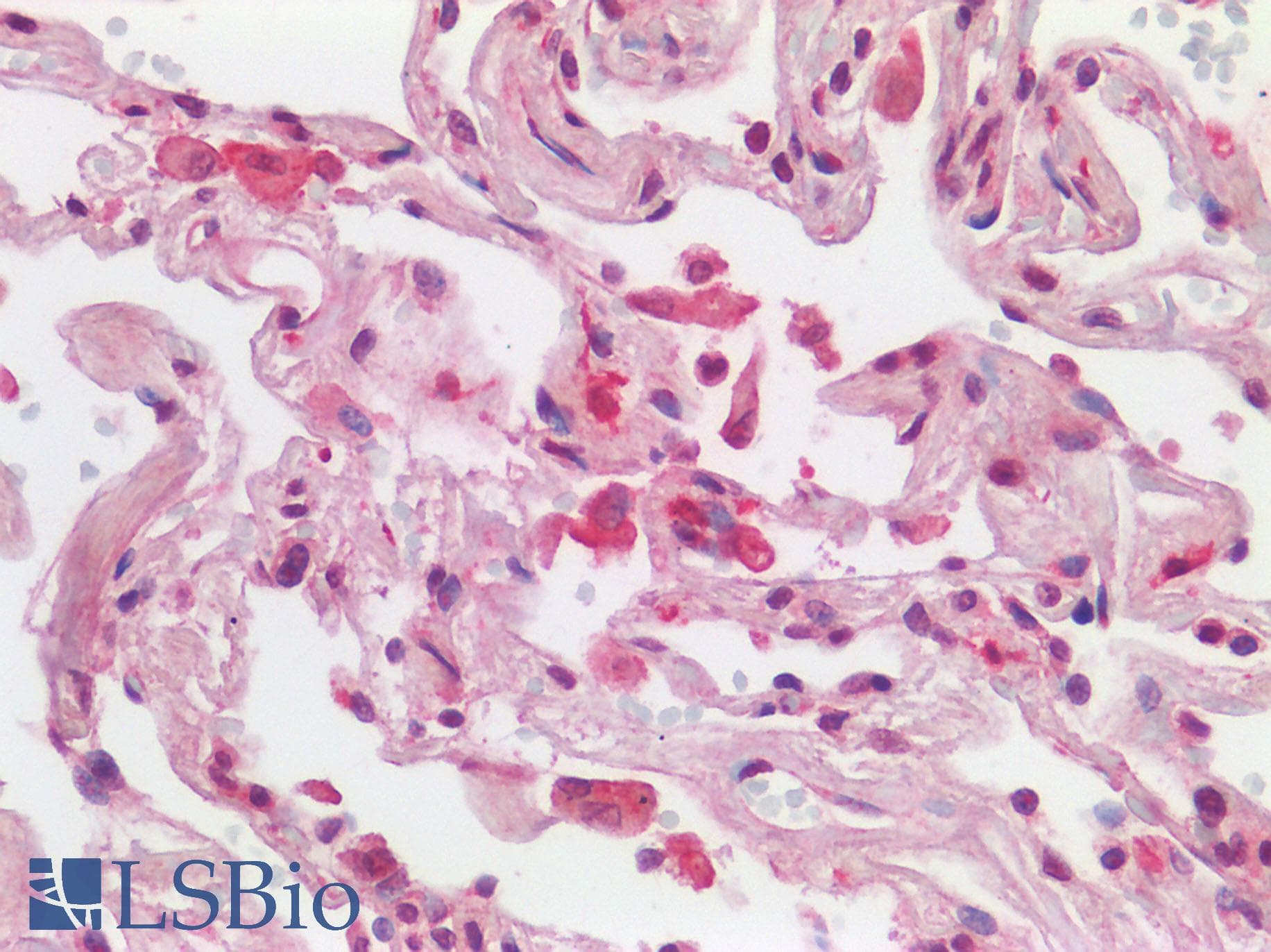 IHC-plus™ AIF1 / IBA1 Antibody (C-Terminus)