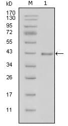 IHC-plus™ LAMB1 / Laminin Beta 1 Antibody (clone 2D9G5)