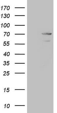 MAK Antibody (aa291-623, clone OTI5A7)