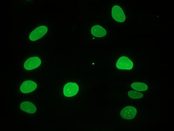 PathPlus™ LMNA / Lamin A+C Antibody (clone 133A2)