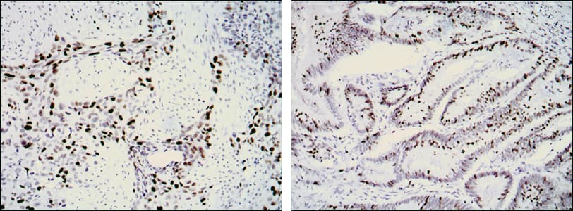 NIFK / MKI67IP Antibody (clone 8D5)