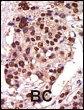 Polyclonal Rabbit anti-Human PKD3 / PRKD3 Antibody (aa352-384, IHC, IF, WB)
