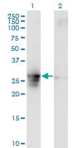 Monoclonal Mouse anti-Human FAM3B Antibody (clone 1E7, IHC, WB)