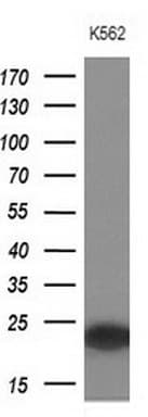 IHC-plus™ MYL4 Antibody (aa2-197, clone 5A2)