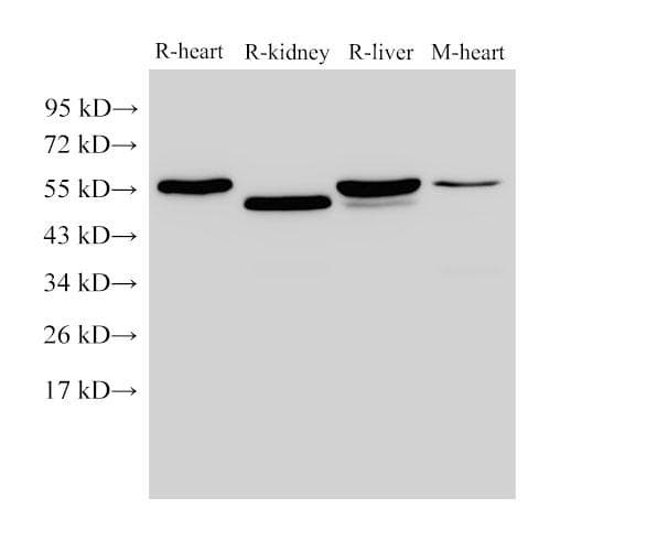 FGB / Fibrinogen Beta Chain Antibody