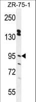 ERMP1 Antibody (aa856-885)